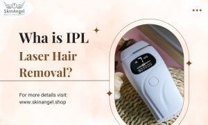 What is IPL Laser Hair Removal